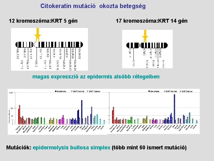 Citokeratin mutáció okozta betegség 12 kromoszóma: KRT 5 gén 17 kromoszóma: KRT 14 gén
