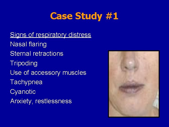 Case Study #1 Signs of respiratory distress Nasal flaring Sternal retractions Tripoding Use of