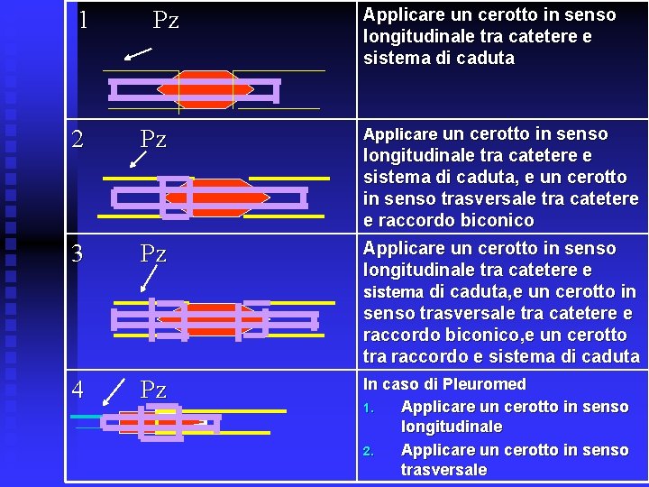 1 Pz Applicare un cerotto in senso longitudinale tra catetere e sistema di caduta