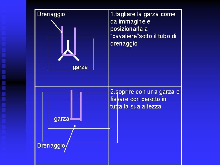 Drenaggio 1. tagliare la garza come da immagine e posizionarla a “cavaliere”sotto il tubo