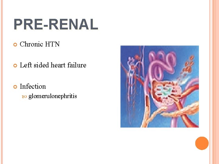 PRE-RENAL Chronic HTN Left sided heart failure Infection glomerulonephritis 