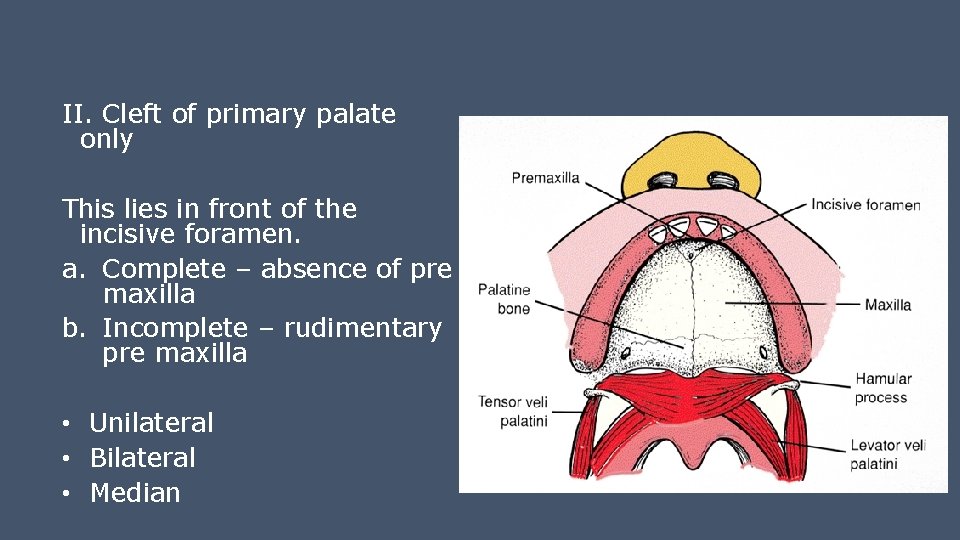II. Cleft of primary palate only This lies in front of the incisive foramen.