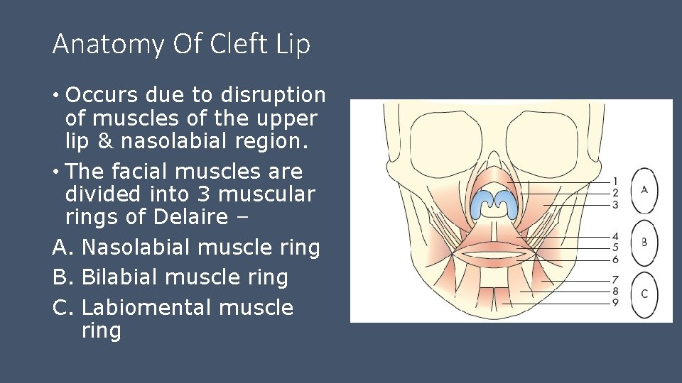 Anatomy Of Cleft Lip • Occurs due to disruption of muscles of the upper