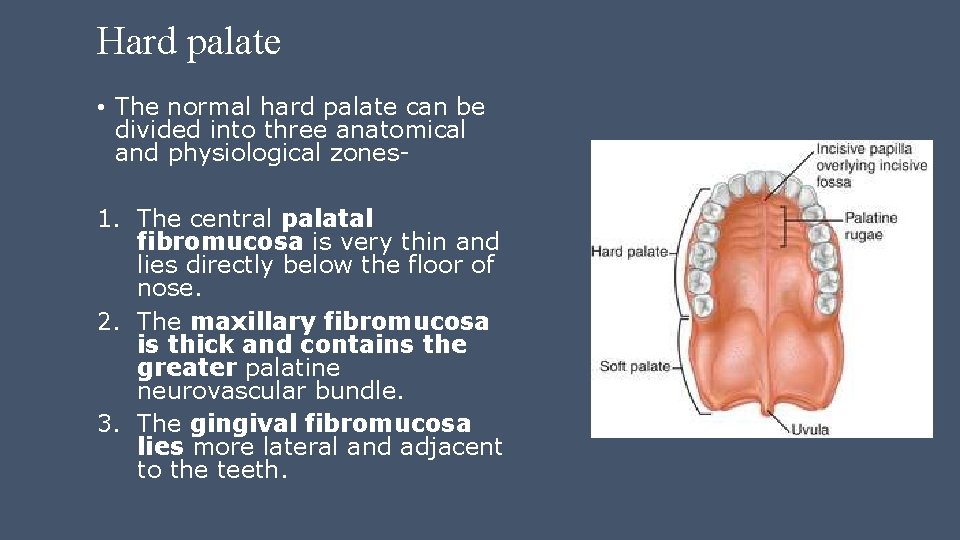 Hard palate • The normal hard palate can be divided into three anatomical and