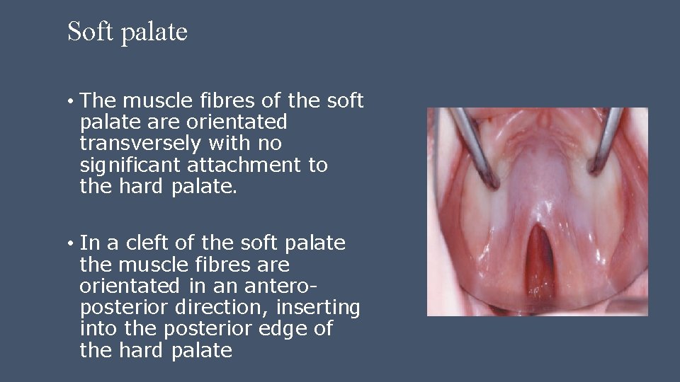 Soft palate • The muscle fibres of the soft palate are orientated transversely with