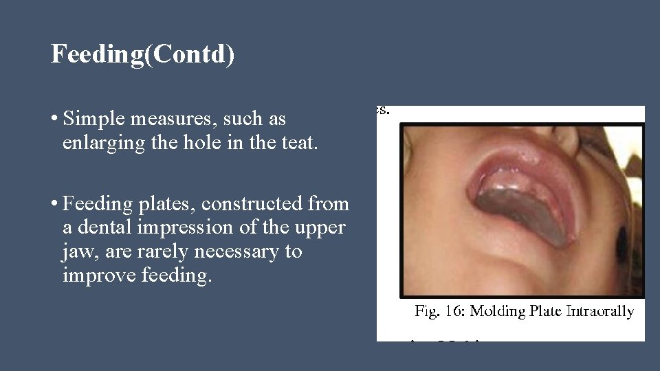 Feeding(Contd) • Simple measures, such as enlarging the hole in the teat. • Feeding