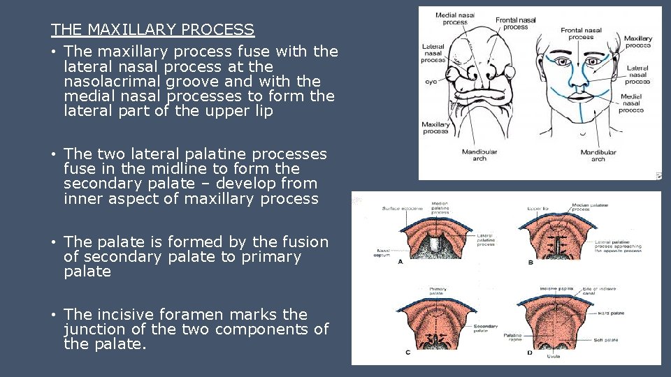 THE MAXILLARY PROCESS • The maxillary process fuse with the lateral nasal process at