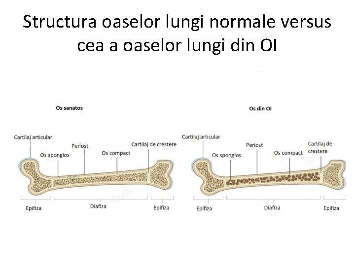 Structura oaselor lungi normale versus cea a oaselor lungi din OI 