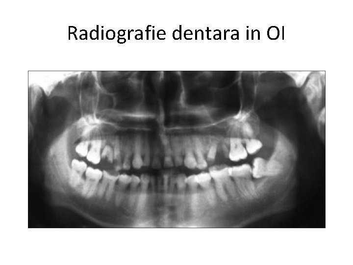 Radiografie dentara in OI 