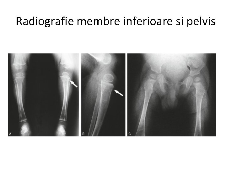 Radiografie membre inferioare si pelvis 