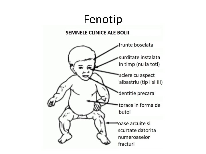 Fenotip 