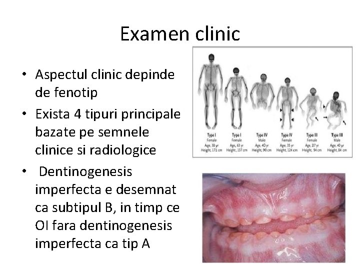 Examen clinic • Aspectul clinic depinde de fenotip • Exista 4 tipuri principale bazate