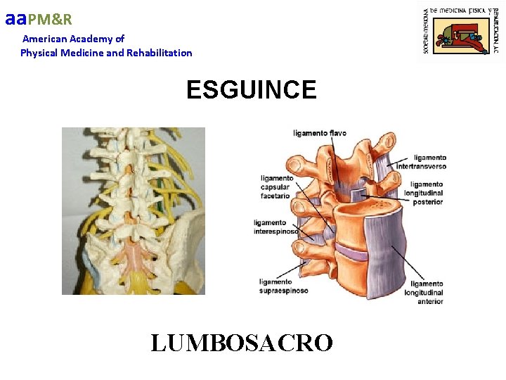 aa. PM&R American Academy of Physical Medicine and Rehabilitation ESGUINCE LUMBOSACRO 