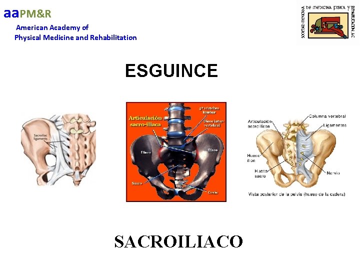 aa. PM&R American Academy of Physical Medicine and Rehabilitation ESGUINCE SACROILIACO 