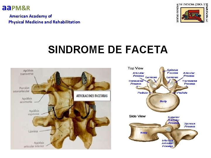 aa. PM&R American Academy of Physical Medicine and Rehabilitation SINDROME DE FACETA 