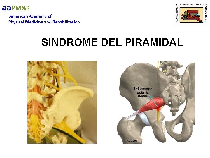 aa. PM&R American Academy of Physical Medicine and Rehabilitation SINDROME DEL PIRAMIDAL 
