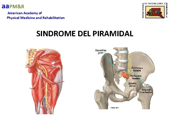 aa. PM&R American Academy of Physical Medicine and Rehabilitation SINDROME DEL PIRAMIDAL 