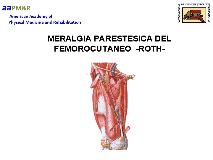 aa. PM&R American Academy of Physical Medicine and Rehabilitation MERALGIA PARESTESICA DEL FEMOROCUTANEO -ROTH-