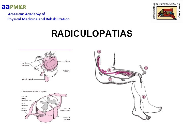 aa. PM&R American Academy of Physical Medicine and Rehabilitation RADICULOPATIAS 