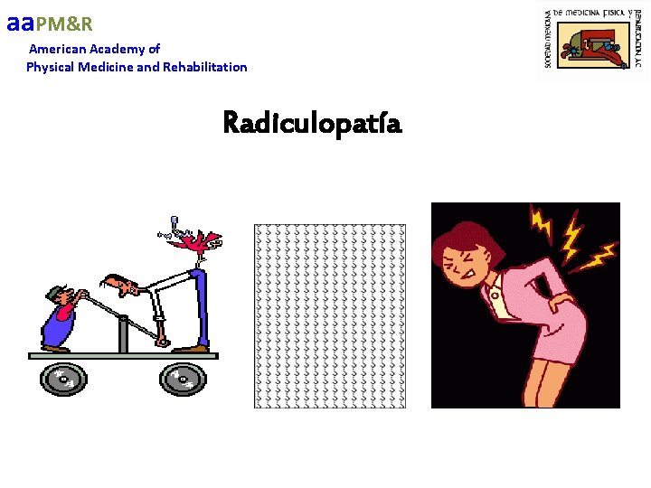 aa. PM&R American Academy of Physical Medicine and Rehabilitation Radiculopatía 