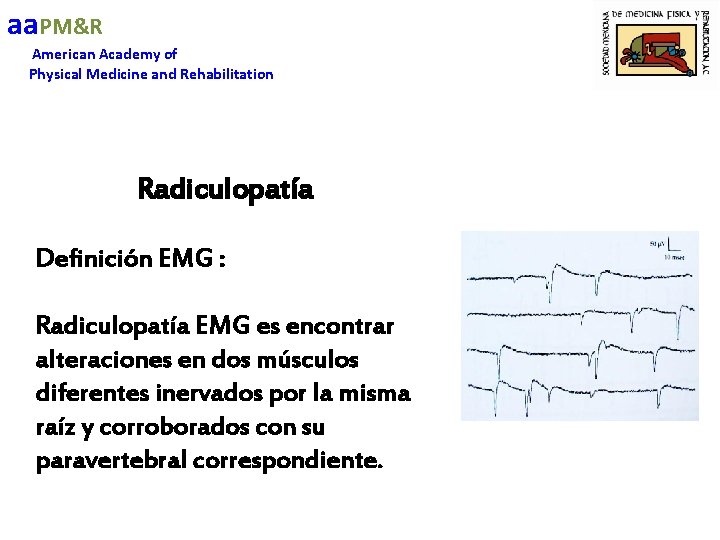 aa. PM&R American Academy of Physical Medicine and Rehabilitation Radiculopatía Definición EMG : Radiculopatía