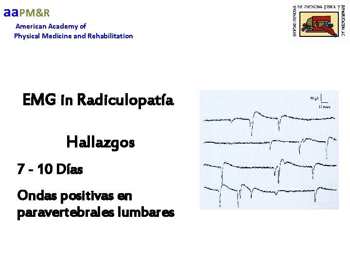 aa. PM&R American Academy of Physical Medicine and Rehabilitation EMG in Radiculopatía Hallazgos 7