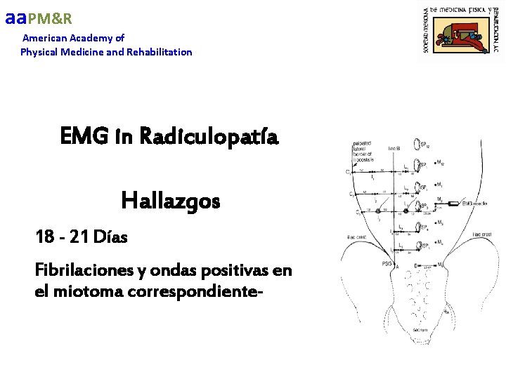 aa. PM&R American Academy of Physical Medicine and Rehabilitation EMG in Radiculopatía Hallazgos 18