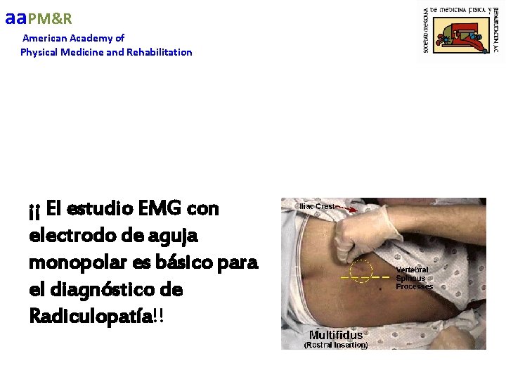 aa. PM&R American Academy of Physical Medicine and Rehabilitation ¡¡ El estudio EMG con