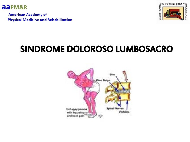 aa. PM&R American Academy of Physical Medicine and Rehabilitation SINDROME DOLOROSO LUMBOSACRO 