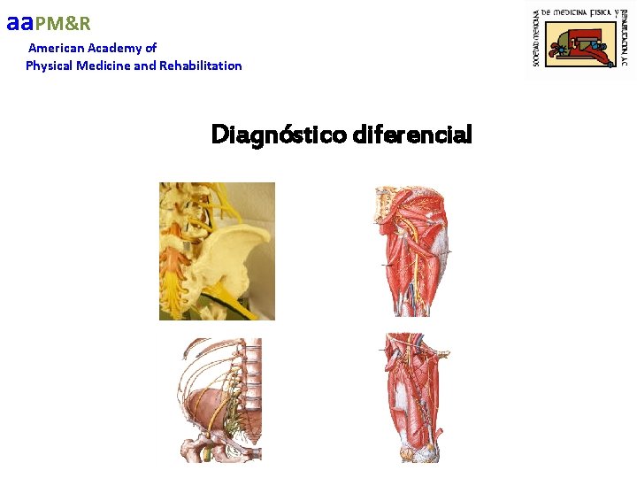 aa. PM&R American Academy of Physical Medicine and Rehabilitation Diagnóstico diferencial 