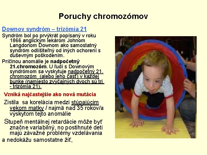 Poruchy chromozómov Downov syndróm – trizómia 21 Syndróm bol po prvýkrát popísaný v roku