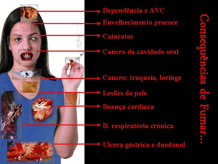 Envelhecimento precoce Cataratas Cancro da cavidade oral Cancro: traqueia, laringe Lesões da pele Doença