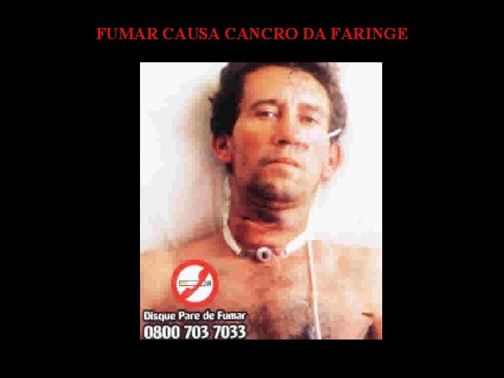 FUMAR CAUSA CANCRO DA FARINGE 