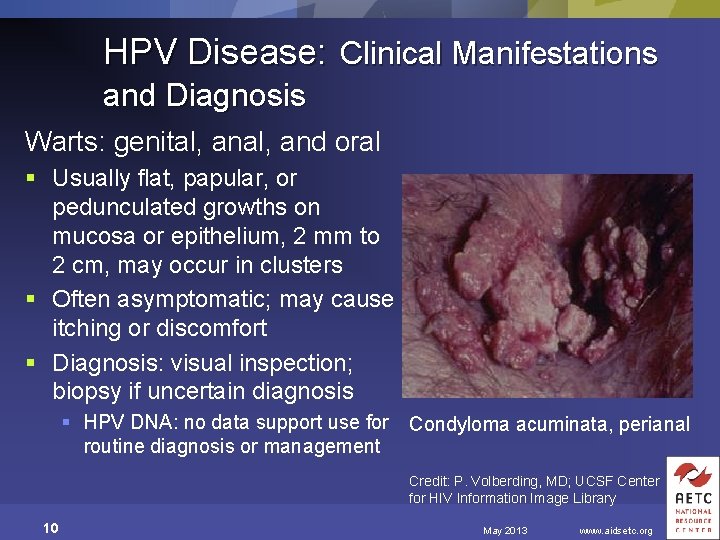 HPV Disease: Clinical Manifestations and Diagnosis Warts: genital, and oral § Usually flat, papular,