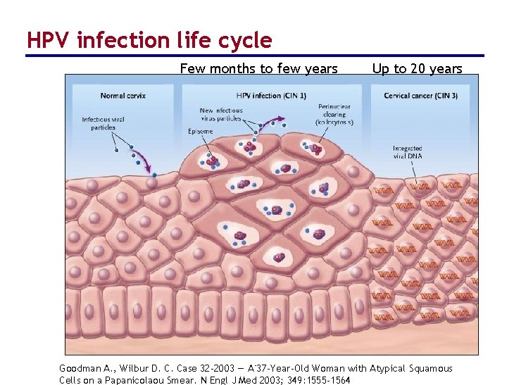 HPV infection life cycle Few months to few years 5 Up to 20 years