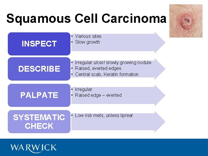 Squamous Cell Carcinoma INSPECT DESCRIBE PALPATE SYSTEMATIC CHECK • Various sites • Slow growth