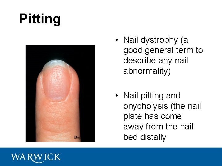 Pitting • Nail dystrophy (a good general term to describe any nail abnormality) •