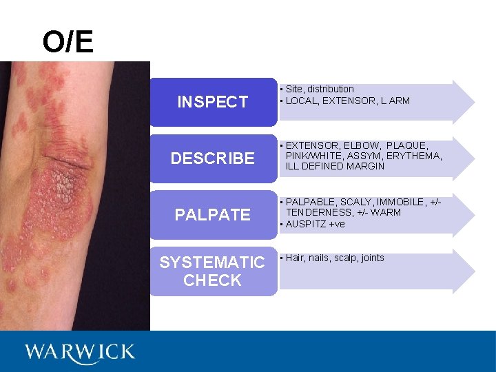 O/E INSPECT • Site, distribution • LOCAL, EXTENSOR, L ARM DESCRIBE • EXTENSOR, ELBOW,