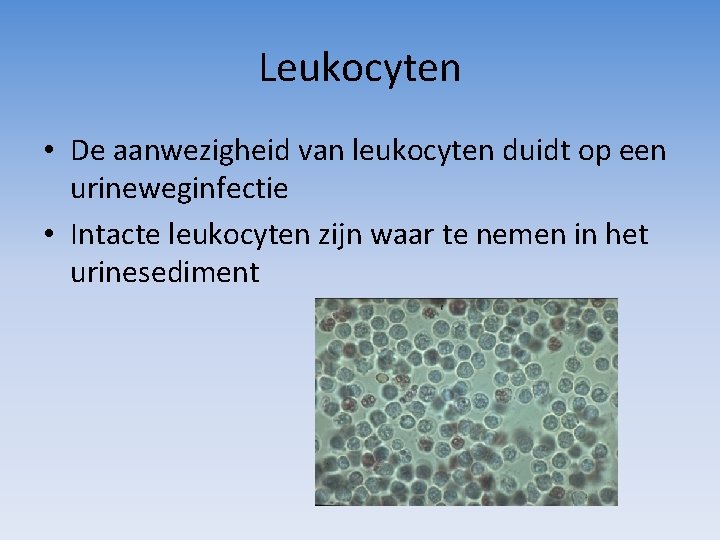 Leukocyten • De aanwezigheid van leukocyten duidt op een urineweginfectie • Intacte leukocyten zijn