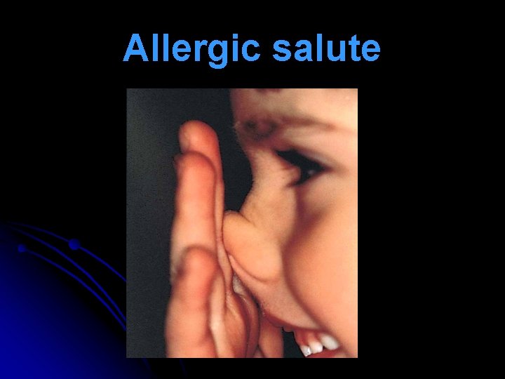 Allergic salute 