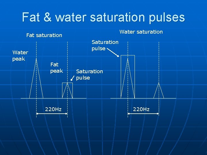 Fat & water saturation pulses Water saturation Fat saturation Water peak Saturation pulse Fat