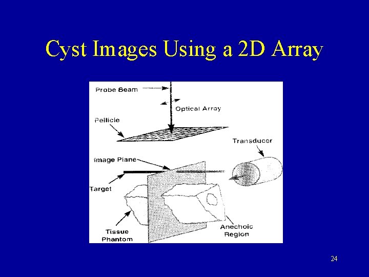 Cyst Images Using a 2 D Array 24 