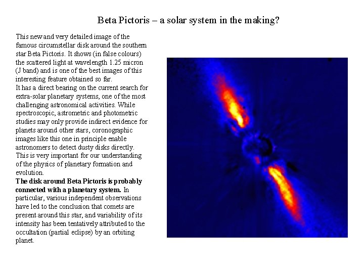 Beta Pictoris – a solar system in the making? This new and very detailed