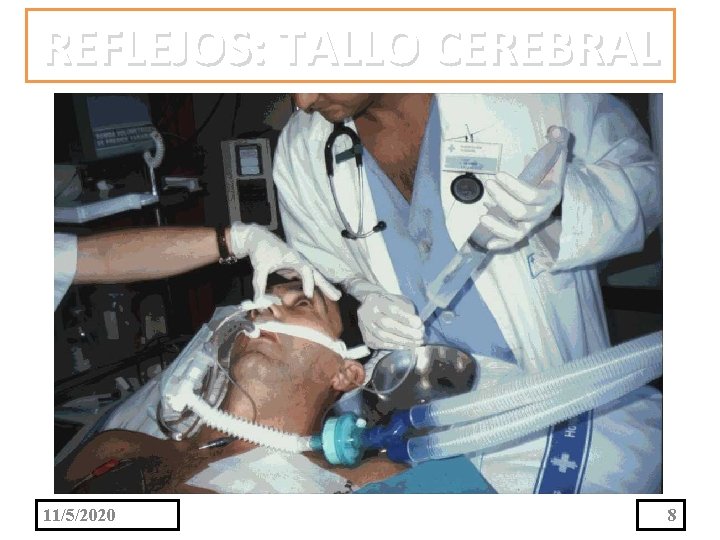 REFLEJOS: TALLO CEREBRAL 11/5/2020 8 