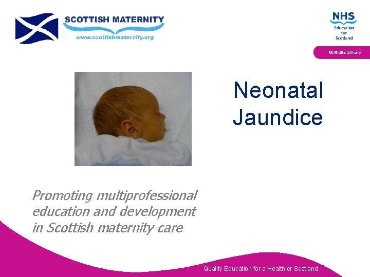 Multidisciplinary Neonatal Jaundice Promoting multiprofessional education and development in Scottish maternity care Quality Education