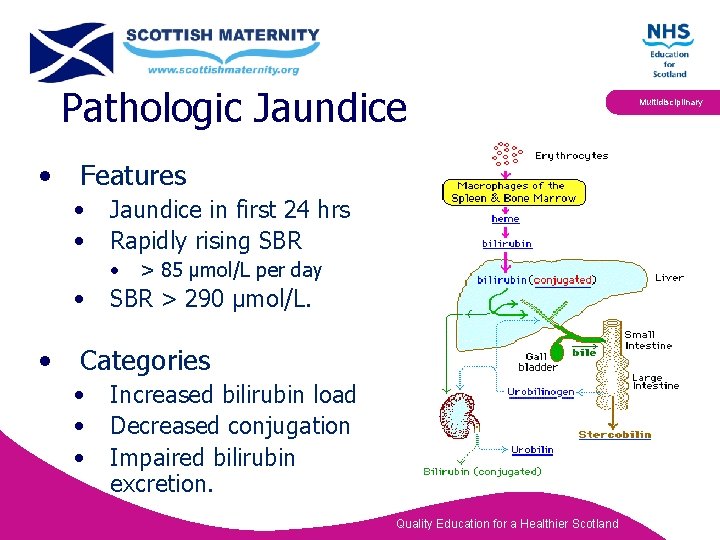 Pathologic Jaundice • Features • • Jaundice in first 24 hrs Rapidly rising SBR