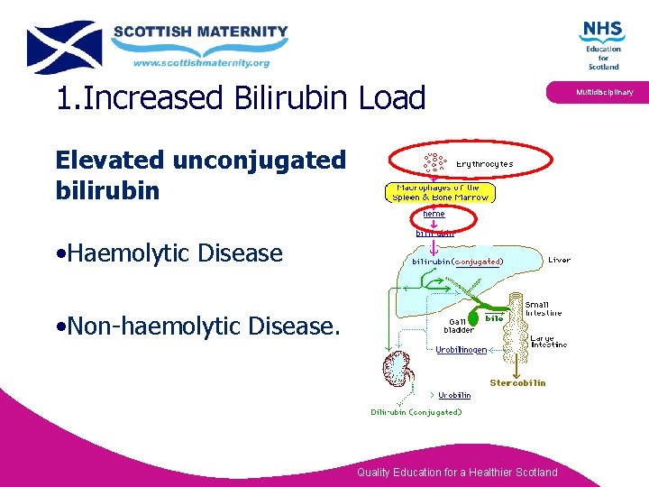 1. Increased Bilirubin Load Elevated unconjugated bilirubin • Haemolytic Disease • Non-haemolytic Disease. Quality