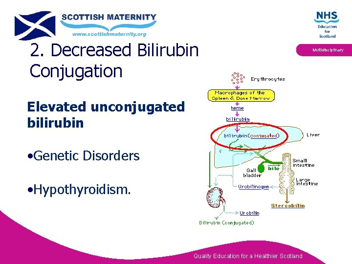 2. Decreased Bilirubin Conjugation Elevated unconjugated bilirubin • Genetic Disorders • Hypothyroidism. Quality Education