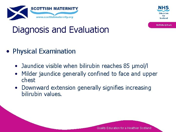 Diagnosis and Evaluation Multidisciplinary • Physical Examination • Jaundice visible when bilirubin reaches 85