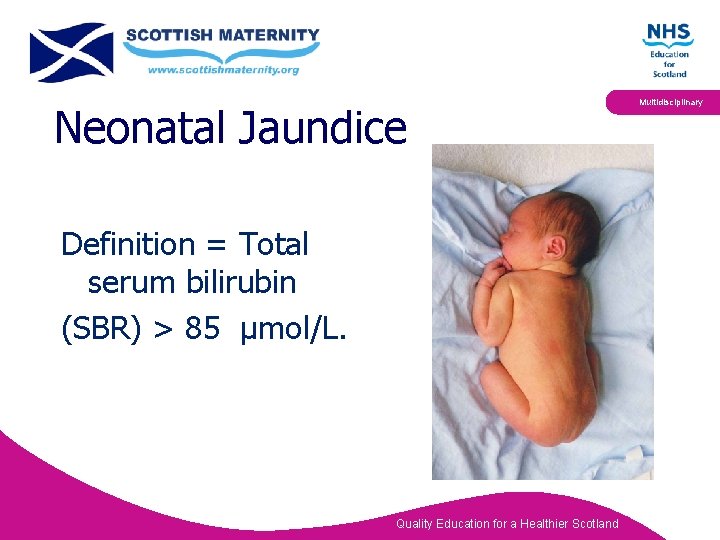 Neonatal Jaundice Definition = Total serum bilirubin (SBR) > 85 µmol/L. Quality Education for